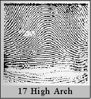 higharch